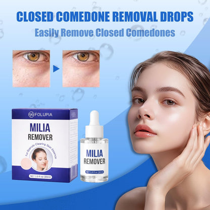 Milia Remover Treatment Serum with Salicylic Acid - Eye & Face Milia Spot Treatment, 1 Fl Oz Avelisse
