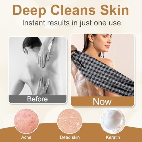 Blissal Exfoliating Shower Towel – Premium Microfiber Scrub Towel, Quick-Drying, Durable & Gentle, 2-in-1 Body Scrubber for All Skin Types (Black + Pink) Avelisse