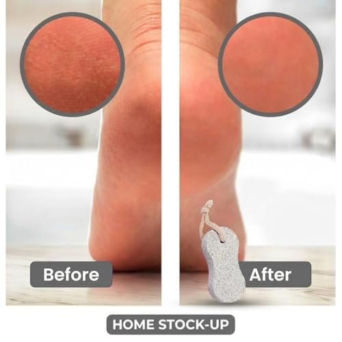 Natural Pumice Stone Pack of 2 – Gentle Exfoliation for Feet & Hands, Callus & Dead Skin Remover - görsel 11