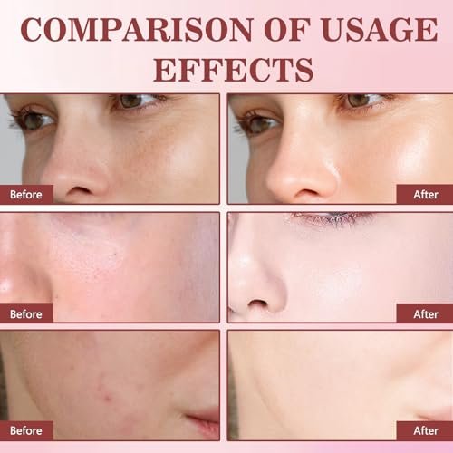 Lucift Dragon Blood Retinol Cream - 2 Pack Anti-Aging Face Moisturizer with Dragon's Blood & Retinol, Firming & Wrinkle Reducing Cream for Women Avelisse