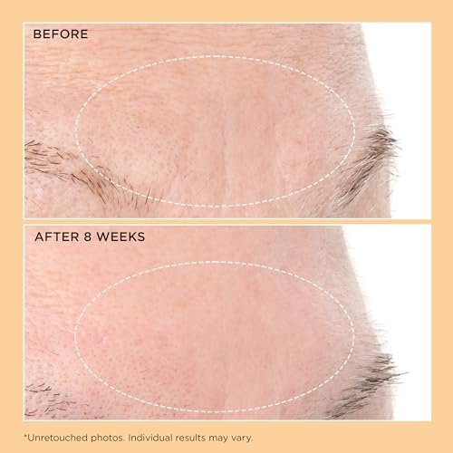 Perricone MD Neuropeptide Deep Crease Serum – Firming & Anti-Aging Serum for Deep Wrinkles, 1 fl oz Avelisse