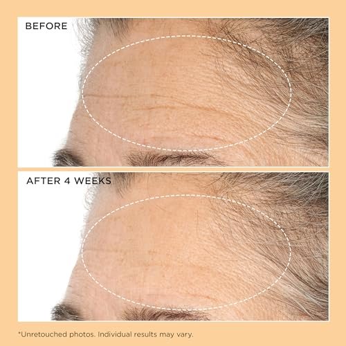 Perricone MD Neuropeptide Deep Crease Serum – Firming & Anti-Aging Serum for Deep Wrinkles, 1 fl oz Avelisse