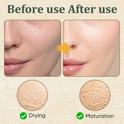 Retinol Golden Micro Peptide Tallow Serum – Tallow-Based Facial Essence with Peptides, Daily Skin Conditioning & Moisture Support, 100ml/3.38 FL OZ Avelisse