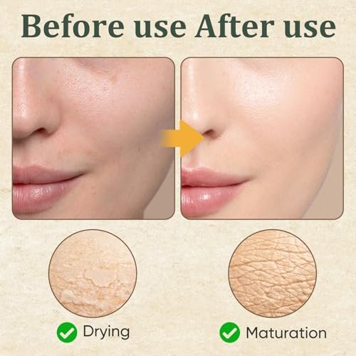 Retinol Golden Micro Peptide Tallow Serum – Tallow-Based Facial Essence with Peptides, Daily Skin Conditioning & Moisture Support, 100ml/3.38 FL OZ Avelisse