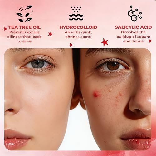 Shivrise Star Pimple Patches - 240 Counts, Star Shape Hydrocolloid Acne Patches for Face, Cover Blemishes & Zits, 3 Sizes & 6 Colors - görsel 4