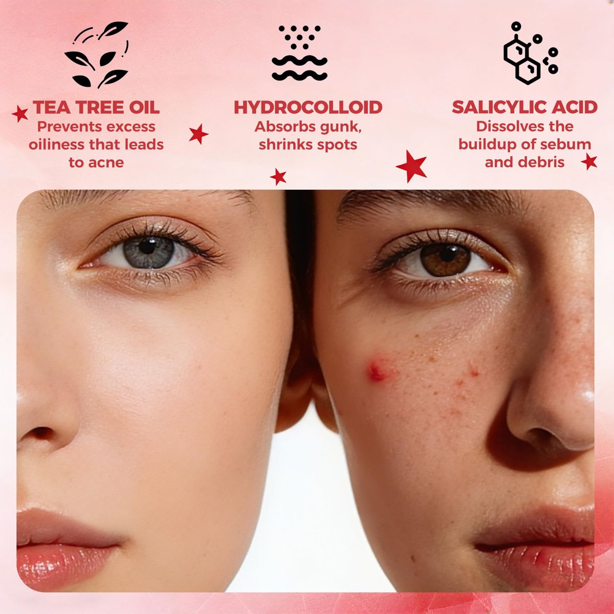 Shivrise Star Pimple Patches - 240 Counts, Star Shape Hydrocolloid Acne Patches for Face, Cover Blemishes & Zits, 3 Sizes & 6 Colors - görsel 3