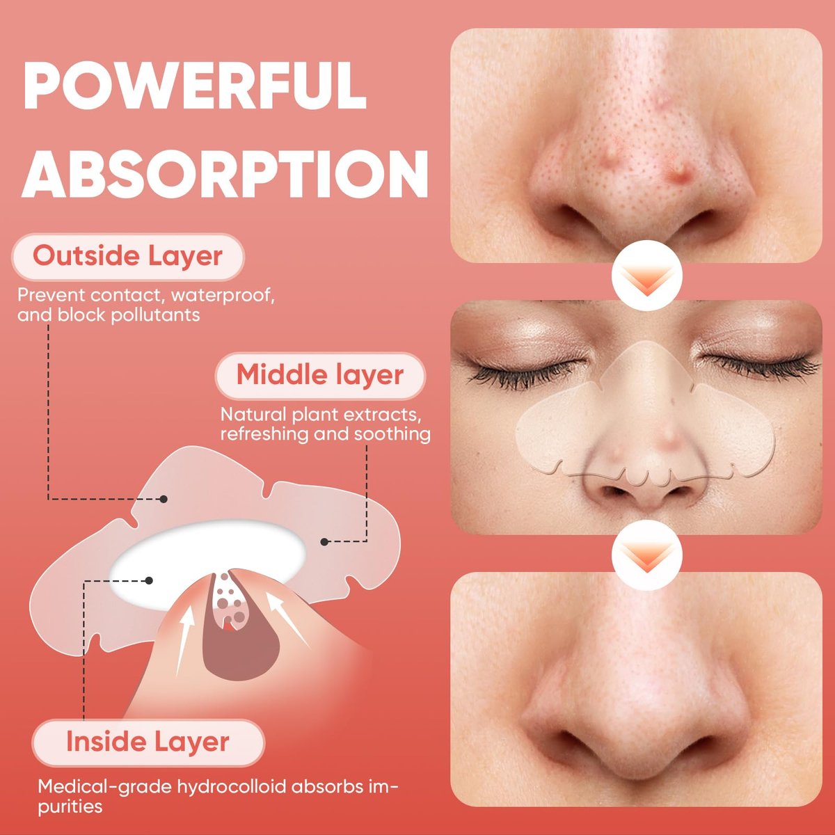 Kindshine 30 Pcs Nose Pimple Patches, Medical-Grade Hydrocolloid Pore Strips with Salicylic Acid, Centella Asiatica & Tea Tree Oil for Oil Control & Pore Refining - Overnight Nose Strips - görsel 11