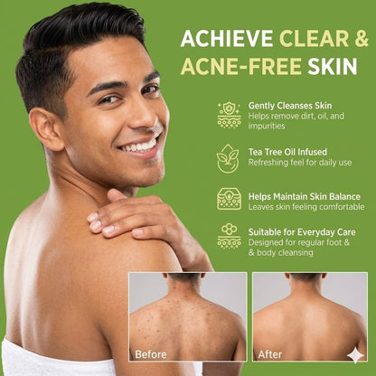 2 Pack Tea Tree Soap - Antifungal Soap for Men & Women, Tea Tree Oil Soap Bar for Foot & Body, Plant-Based Exfoliating & Non-Drying, Includes Foaming Net (4 oz Each)