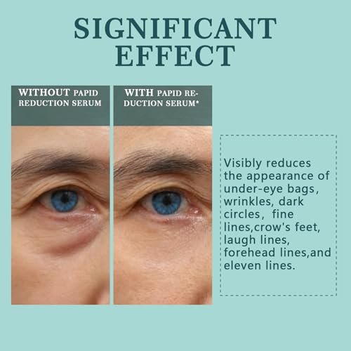 Instant Under Eye Lift Serum - Eye Tightener Cream for Bags, Wrinkles, Dark Circles & Fine Lines - Anti-Aging Wrinkle Remover, 0.5 FL OZ Avelisse