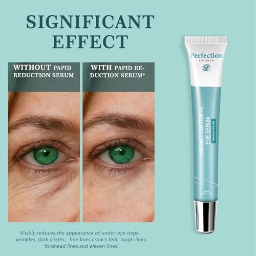 Instant Under Eye Lift Serum - Eye Tightener Cream for Bags, Wrinkles, Dark Circles & Fine Lines - Anti-Aging Wrinkle Remover, 0.5 FL OZ Avelisse