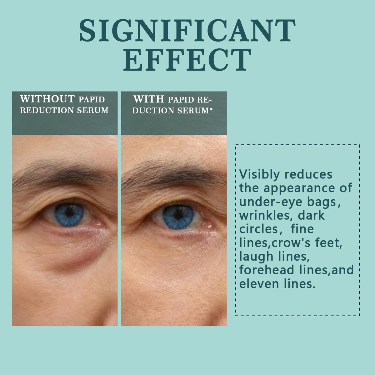 Instant Under Eye Lift Serum - Eye Tightener Cream for Bags, Wrinkles, Dark Circles & Fine Lines - Anti-Aging Wrinkle Remover, 0.5 FL OZ Avelisse