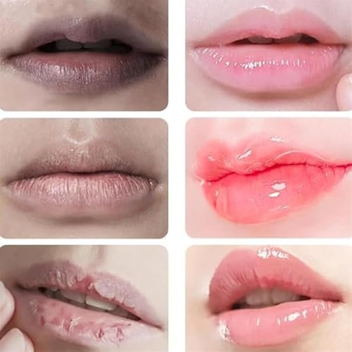 Lip Lightening Serum for Dark Lips - Brightening Treatment with Vitamin C, Jojoba Oil & Licorice for Smokers, Dry or Uneven Lips - Restore Natural Moisture & Color Avelisse