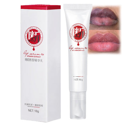 Lip Lightening Serum for Dark Lips - Brightening Treatment with Vitamin C, Jojoba Oil & Licorice for Smokers, Dry or Uneven Lips - Restore Natural Moisture & Color Avelisse