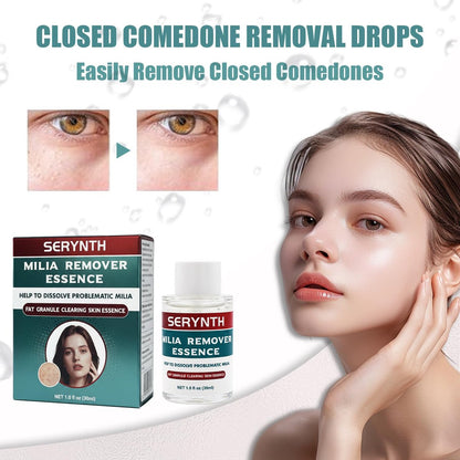 SERYNTH Milia Remover Serum with Salicylic Acid for Eyes and Face | 1 Fl Oz Avelisse