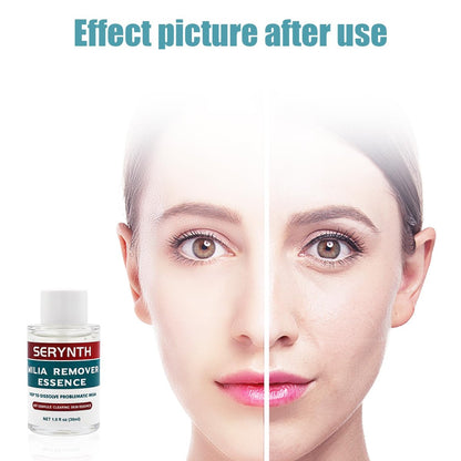 SERYNTH Milia Remover Serum with Salicylic Acid for Eyes and Face | 1 Fl Oz Avelisse