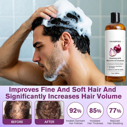 MYSQIHO Onion Shampoo for Hair Growth with Rosemary Oil, Red Onion & Cinnamon Extract, Strengthen Hair Roots, Reduce Hair Loss, Promote Hair Growth for Women and Men, 7 Fl Oz Avelisse
