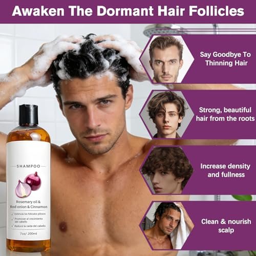 MYSQIHO Onion Shampoo for Hair Growth with Rosemary Oil, Red Onion & Cinnamon Extract, Strengthen Hair Roots, Reduce Hair Loss, Promote Hair Growth for Women and Men, 7 Fl Oz Avelisse