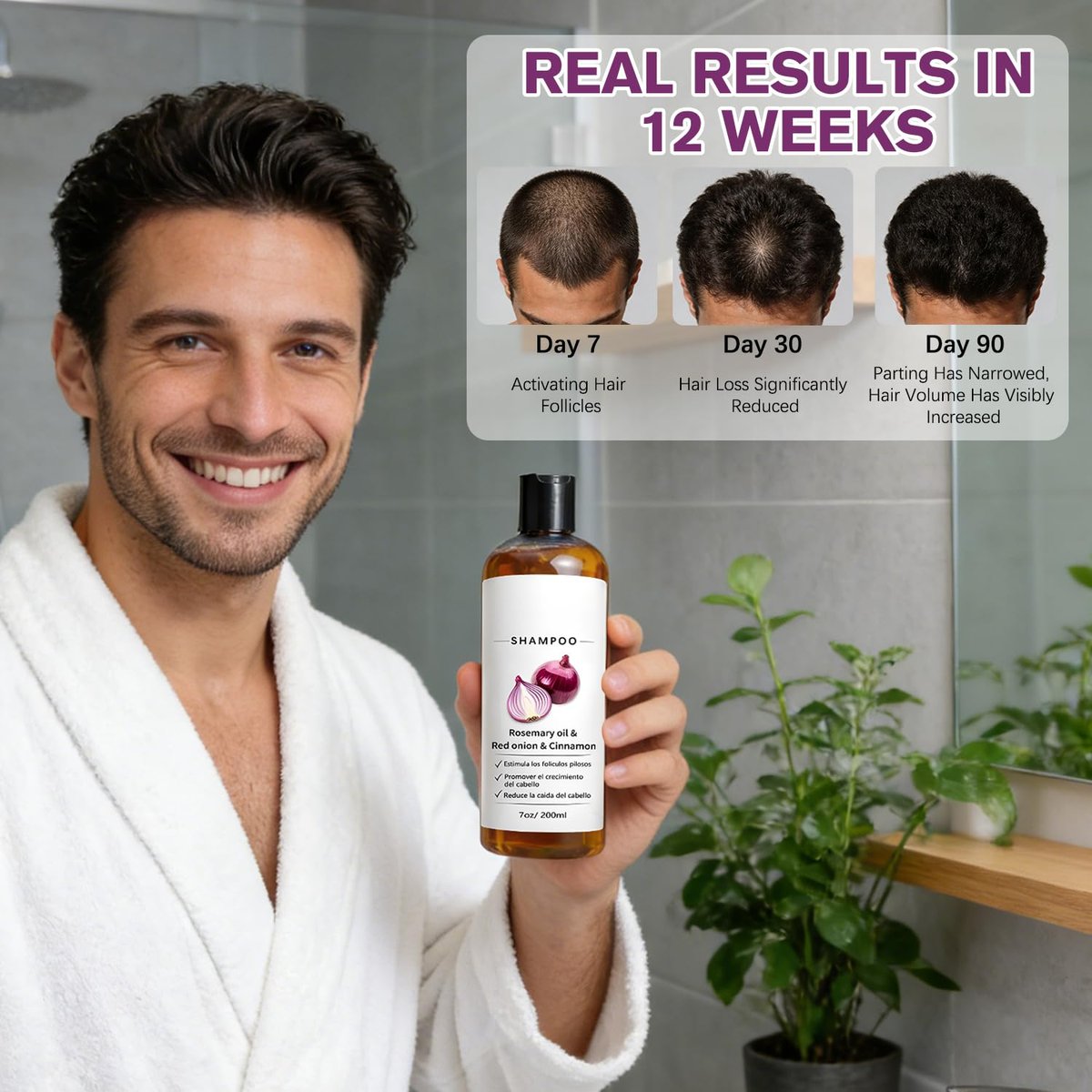 MYSQIHO Onion Shampoo for Hair Growth with Rosemary Oil, Red Onion & Cinnamon Extract, Strengthen Hair Roots, Reduce Hair Loss, Promote Hair Growth for Women and Men, 7 Fl Oz Avelisse