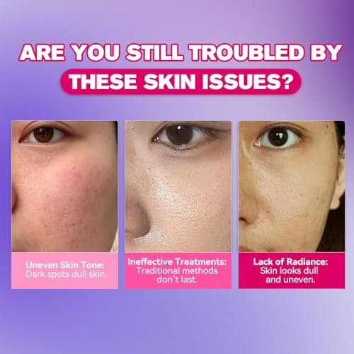 Dark Spot Remover for Face and Body - Dark Spot Corrector Serum for Face - Sun Spots, Age Spots, Freckles & Melasma Remover - Brown Spot Corrector Evens Skin Tone Skin Care for All Skin Type 1.7 Fl Oz Avelisse