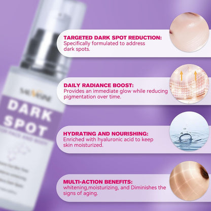 Dark Spot Remover for Face and Body - Dark Spot Corrector Serum for Face - Sun Spots, Age Spots, Freckles & Melasma Remover - Brown Spot Corrector Evens Skin Tone Skin Care for All Skin Type 1.7 Fl Oz Avelisse
