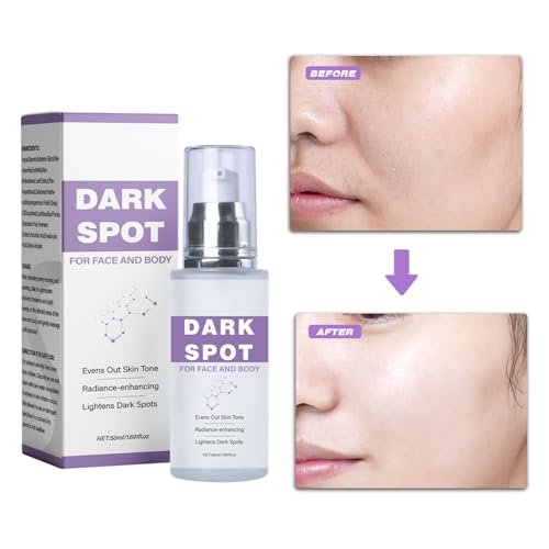 Dark Spot Remover for Face and Body - Dark Spot Corrector Serum for Face - Sun Spots, Age Spots, Freckles & Melasma Remover - Brown Spot Corrector Evens Skin Tone Skin Care for All Skin Type 1.7 Fl Oz Avelisse