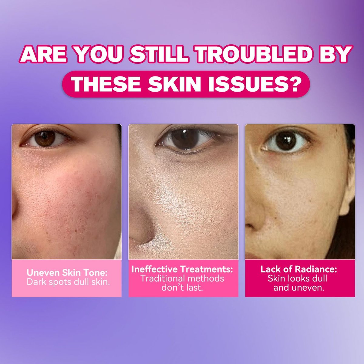 Dark Spot Remover for Face and Body - Dark Spot Corrector Serum for Face - Sun Spots, Age Spots, Freckles & Melasma Remover - Brown Spot Corrector Evens Skin Tone Skin Care for All Skin Type 1.7 Fl Oz Avelisse