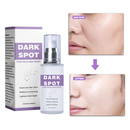 Dark Spot Remover for Face and Body - Dark Spot Corrector Serum for Face - Sun Spots, Age Spots, Freckles & Melasma Remover - Brown Spot Corrector Evens Skin Tone Skin Care for All Skin Type 1.7 Fl Oz Avelisse