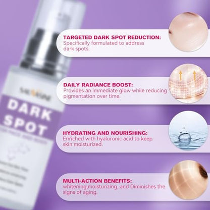 Dark Spot Remover for Face and Body - Dark Spot Corrector Serum for Face - Sun Spots, Age Spots, Freckles & Melasma Remover - Brown Spot Corrector Evens Skin Tone Skin Care for All Skin Type 1.7 Fl Oz Avelisse