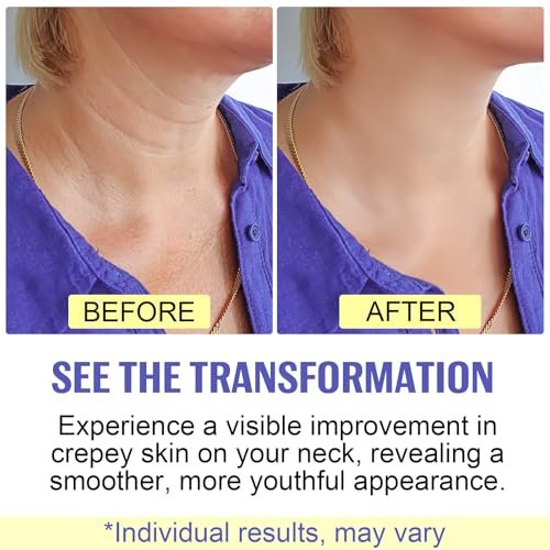 Neck Firming Cream - Anti Aging Neck Tightening Cream for Sagging Skin, 1.7 Fl Oz with 4% Cupuacu Butter, Hyaluronic Acid & Caffeine - Lifts Wrinkles & Fine Lines for Women & Men - görsel 12