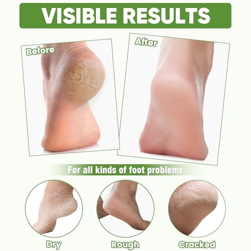 TEAWOO 8 Pairs Moisturizing Foot Masks with Aloe Vera Extract & Jojoba Oil – Intensely Hydrating Socks for Dry, Cracked Feet & Heel Treatment - görsel 6