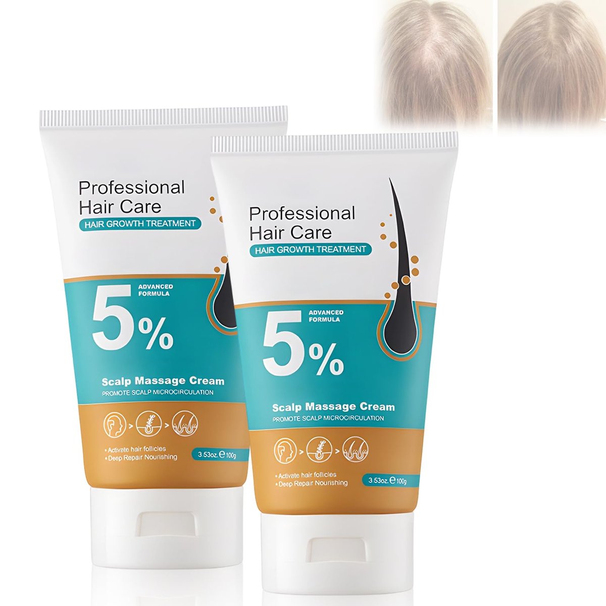 2-Pack Hair Growth Scalp Massage Cream with Rosemary & Biotin - Anti-Hair Loss Treatment for Men & Women - Strengthens Hair Roots Avelisse