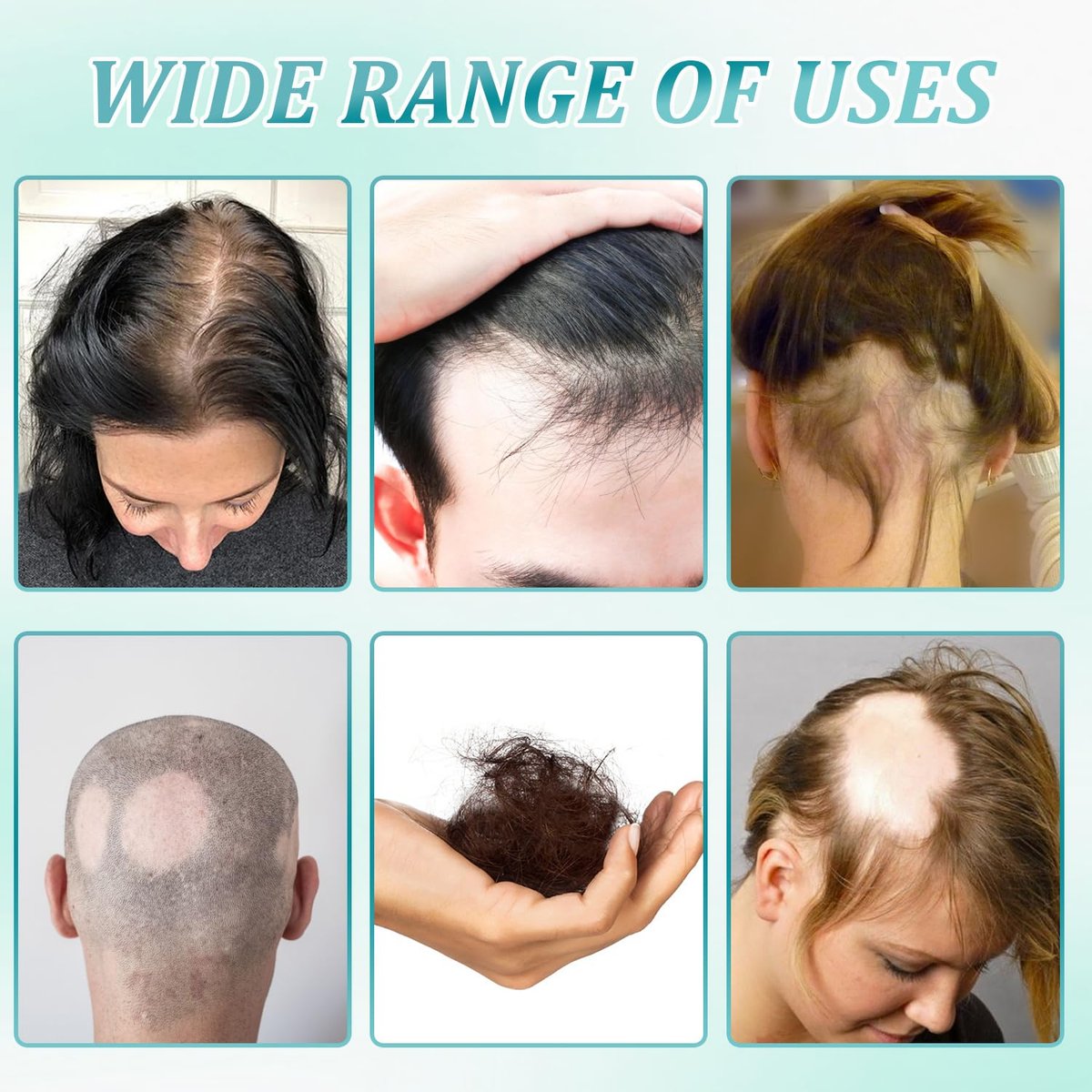2-Pack Hair Growth Scalp Massage Cream with Rosemary & Biotin - Anti-Hair Loss Treatment for Men & Women - Strengthens Hair Roots Avelisse