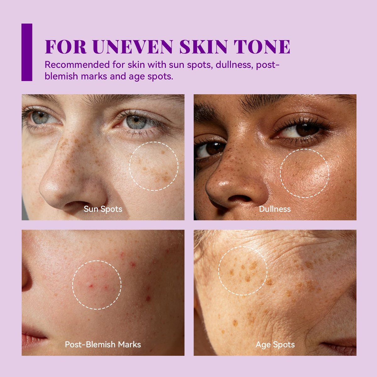 ANAI RUI Tranexamic Acid Cream with 70,000ppm Arbutin & 50,000ppm TXA, 5% Niacinamide - Dark Spot Corrector for Smooth & Even-Looking Skin, 1.7 oz Avelisse