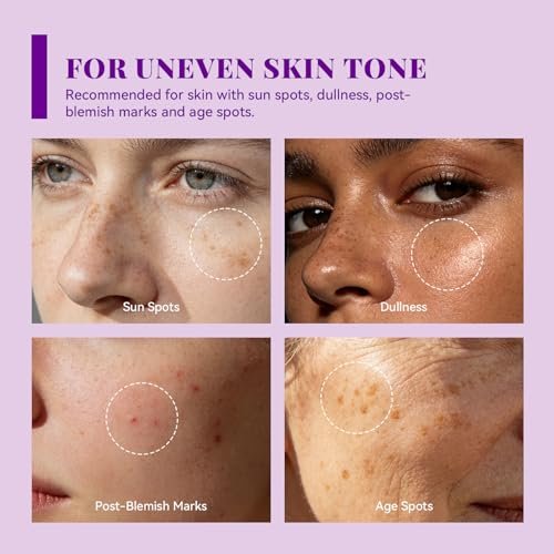 ANAI RUI Tranexamic Acid Cream with 70,000ppm Arbutin & 50,000ppm TXA, 5% Niacinamide - Dark Spot Corrector for Smooth & Even-Looking Skin, 1.7 oz Avelisse
