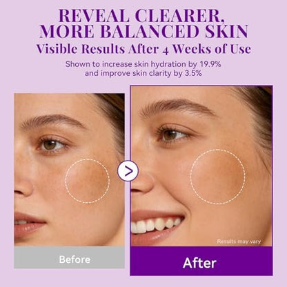 ANAI RUI Tranexamic Acid Cream with 70,000ppm Arbutin & 50,000ppm TXA, 5% Niacinamide - Dark Spot Corrector for Smooth & Even-Looking Skin, 1.7 oz Avelisse