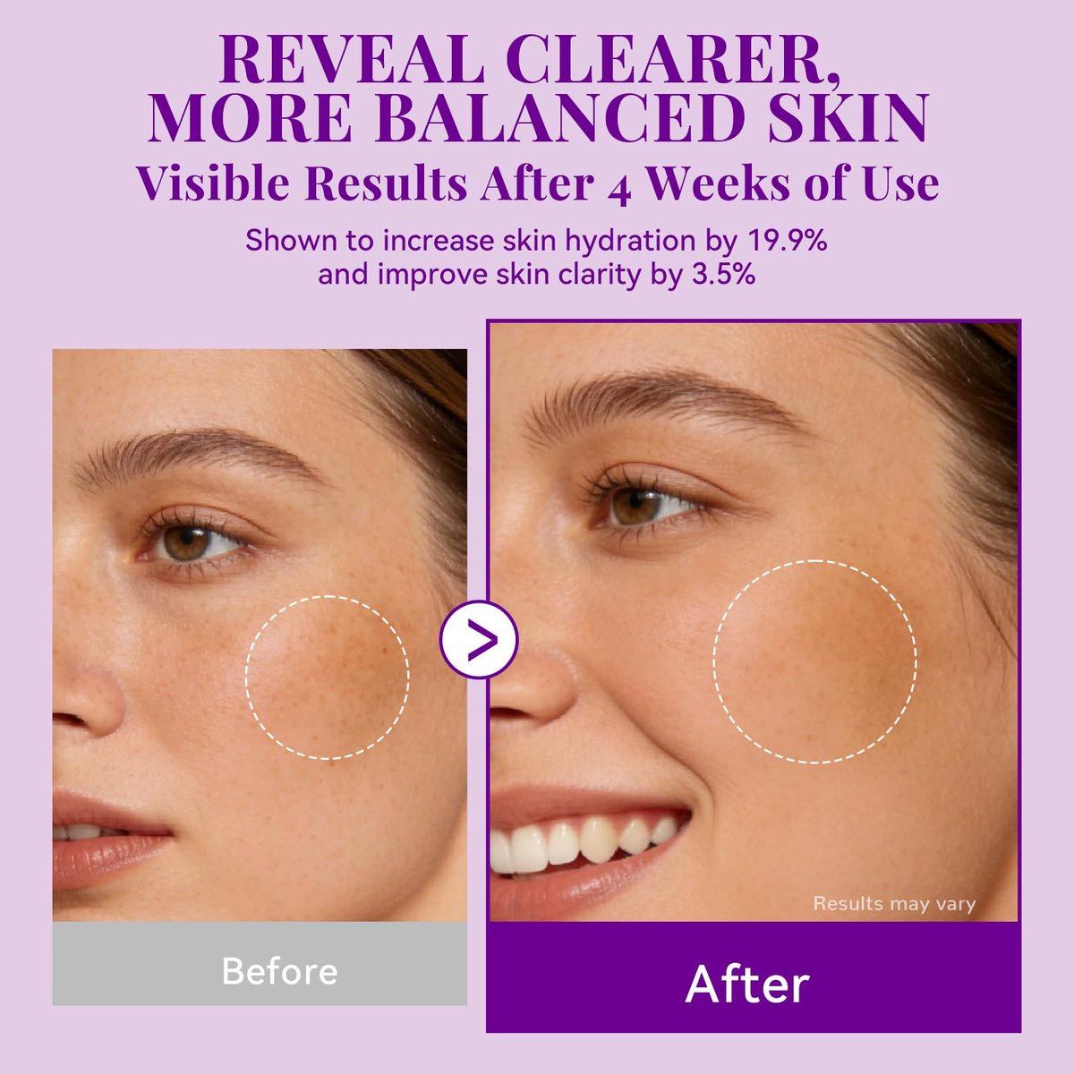 ANAI RUI Tranexamic Acid Cream with 70,000ppm Arbutin & 50,000ppm TXA, 5% Niacinamide - Dark Spot Corrector for Smooth & Even-Looking Skin, 1.7 oz Avelisse