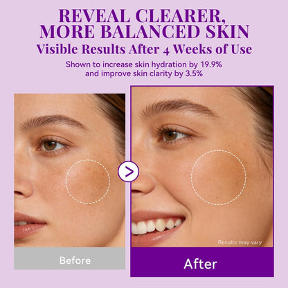 ANAI RUI Tranexamic Acid Cream with 70,000ppm Arbutin & 50,000ppm TXA, 5% Niacinamide - Dark Spot Corrector for Smooth & Even-Looking Skin, 1.7 oz Avelisse