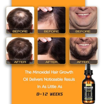 5% Minoxidil Hair Growth Oil for Men and Women – Extra Strength Hair Regrowth Serum, Topical Treatment for Hair Loss, Supports Thicker, Healthier Hair & Beard Growth, 2.11 fl oz Avelisse