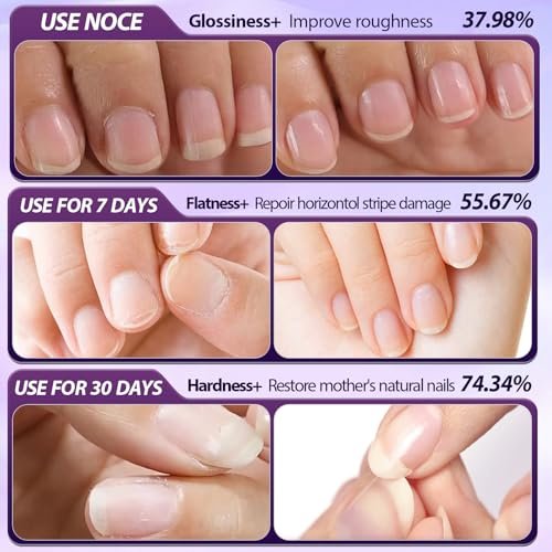 3-Piece Cuticle Oil Pusher Pen Set – 2-in-1 Ceramic Cuticle Pusher & Oil Pen for Manicure & Pedicure, Nail Care for Hangnails, Dry & Damaged Nails - görsel 6
