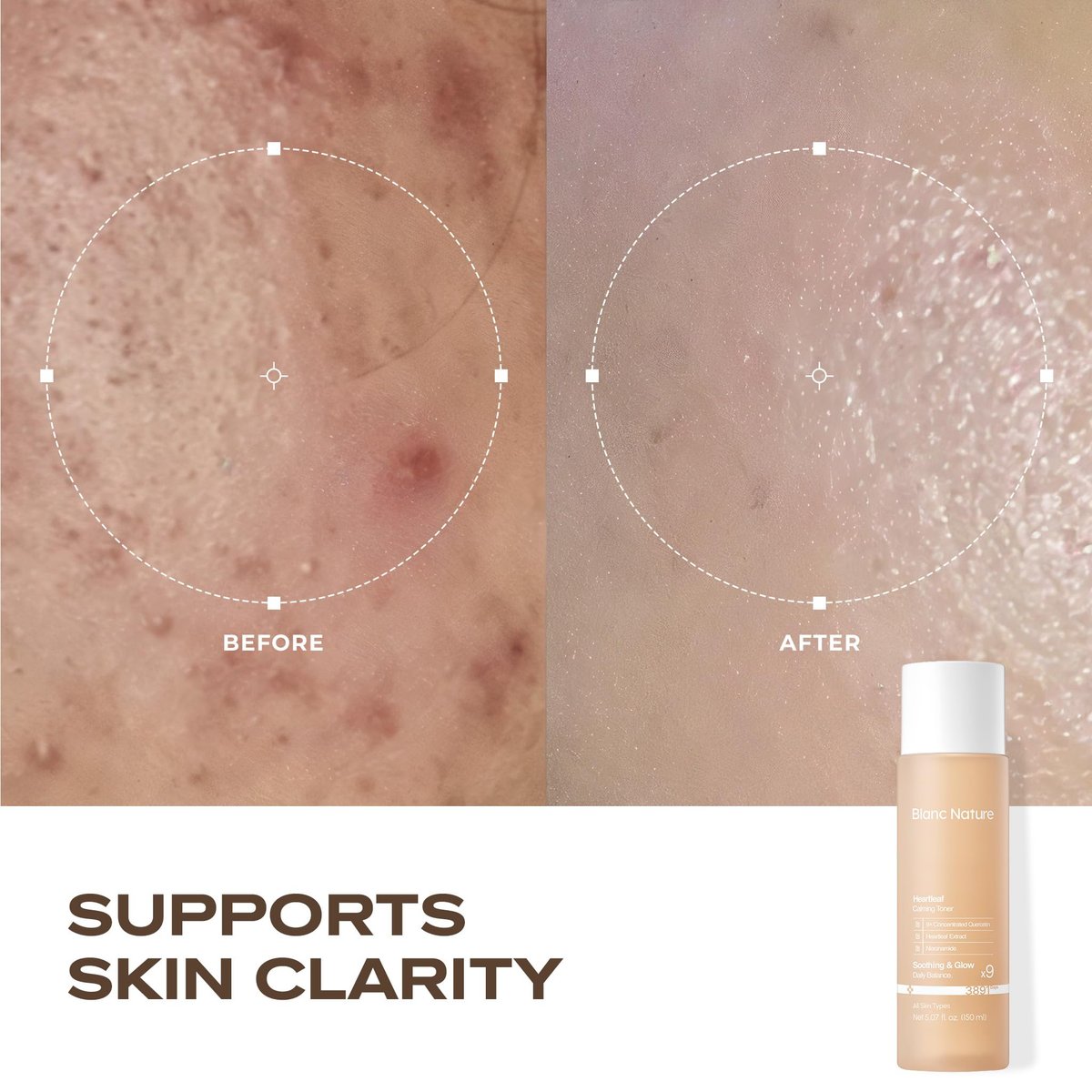 Blanc Nature Heartleaf Calming Toner – Soothing & Hydrating Toner with Heartleaf Extract, Centella Asiatica & Panthenol for All Skin Types – Korean Glass Skin Toner, 150 ml Avelisse