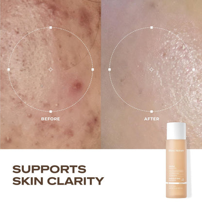 Blanc Nature Heartleaf Calming Toner – Soothing & Hydrating Toner with Heartleaf Extract, Centella Asiatica & Panthenol for All Skin Types – Korean Glass Skin Toner, 150 ml Avelisse