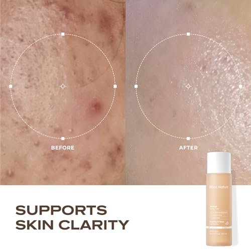 Blanc Nature Heartleaf Calming Toner – Soothing & Hydrating Toner with Heartleaf Extract, Centella Asiatica & Panthenol for All Skin Types – Korean Glass Skin Toner, 150 ml Avelisse