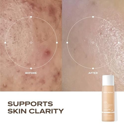 Blanc Nature Heartleaf Calming Toner – Soothing & Hydrating Toner with Heartleaf Extract, Centella Asiatica & Panthenol for All Skin Types – Korean Glass Skin Toner, 150 ml Avelisse