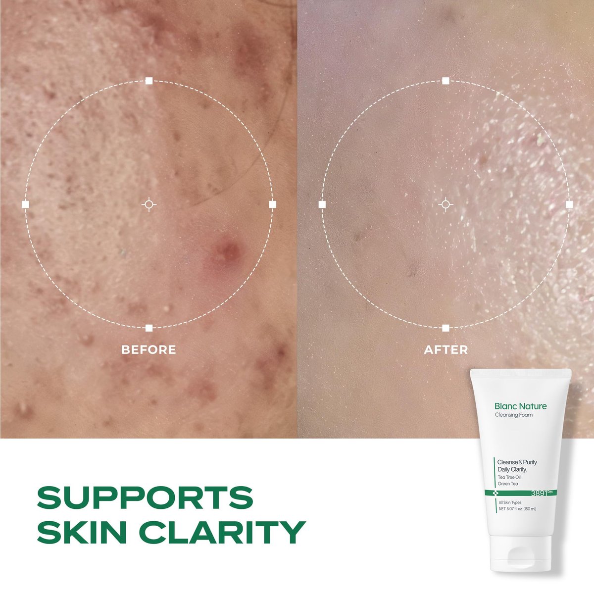 BLANC NATURE Cleansing Foam - Tea Tree Pore Deep Facial Cleanser for Oily & Sensitive Skin with Centella Asiatica and Green Tea, Korean Skincare, 5.07 fl oz (150 ml) Avelisse