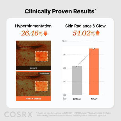COSRX 5-PDRN Complex Collagen Gel Eye Patches – Radiance Care for Tired Under-Eyes with Salmon DNA & Vitamin C, 60 Patches