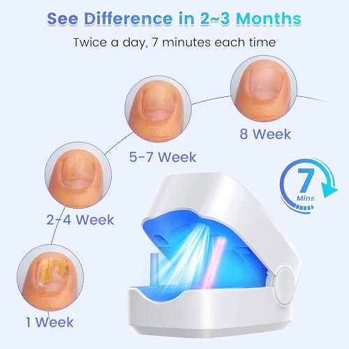 Baimistar Home Toenail Repair Treatment - 7-Minute Timer, Rechargeable Nail Repair Kit for Toenail & Fingernail (White, 1 Fl Oz) - görsel 5