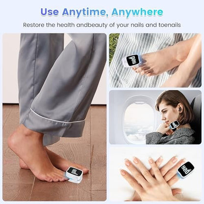Baimistar Home Toenail Repair Treatment - 7-Minute Timer, Rechargeable Nail Repair Kit for Toenail & Fingernail (White, 1 Fl Oz)