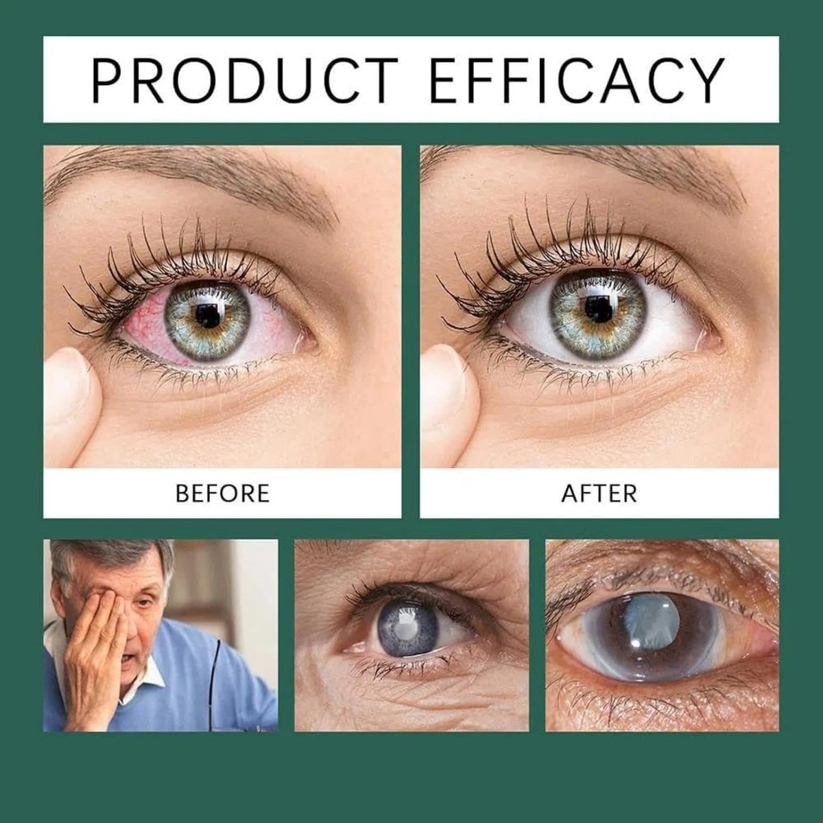 Optifusion Drops - Herbionyx Nano Drop Serum with Lutein, Vitamin C & E (2-Pack) Avelisse
