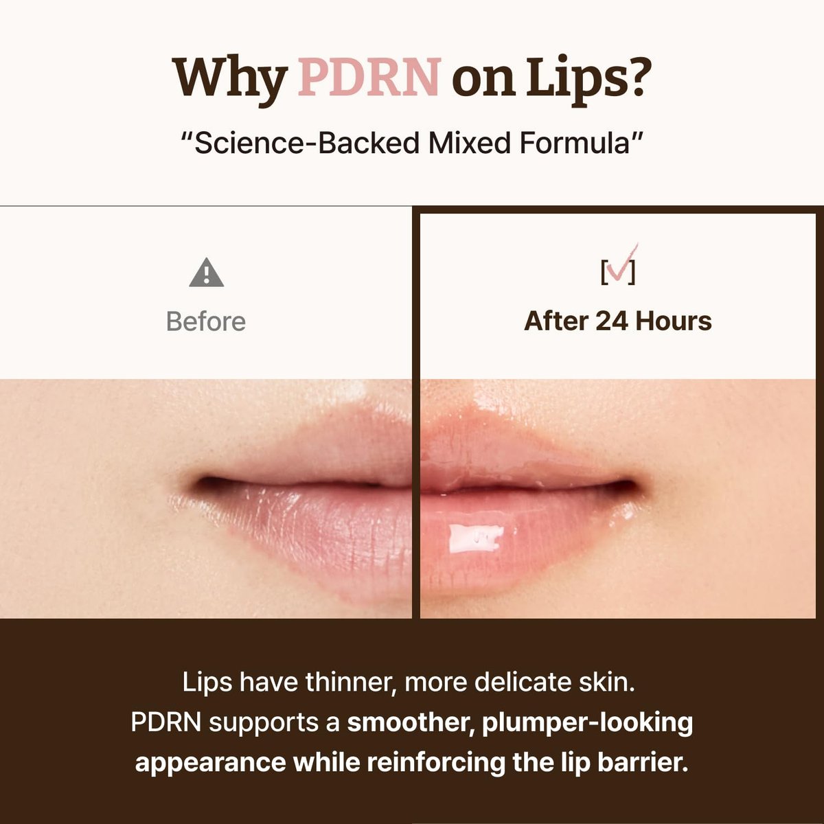 Dr.Reju-All Advanced PDRN Rejuvenating Lip Serum – Hydrating Lip Balm with Lipozip PDRN for Glowy, Dewy Lips – Gentle Exfoliating & Smoothing Lip Moisturizer – Hibiscus & Lactic Acid – 0.3 Fl Oz Avelisse