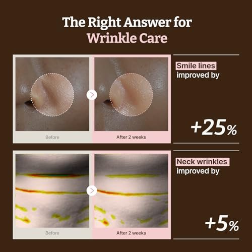 Dr.Reju-All Advanced PDRN Rejuvenating Mask – Face & Neck Korean Sheet Mask with 1,200 ppm PDRN, Collagen & Copper Peptides (4-Pack) Avelisse